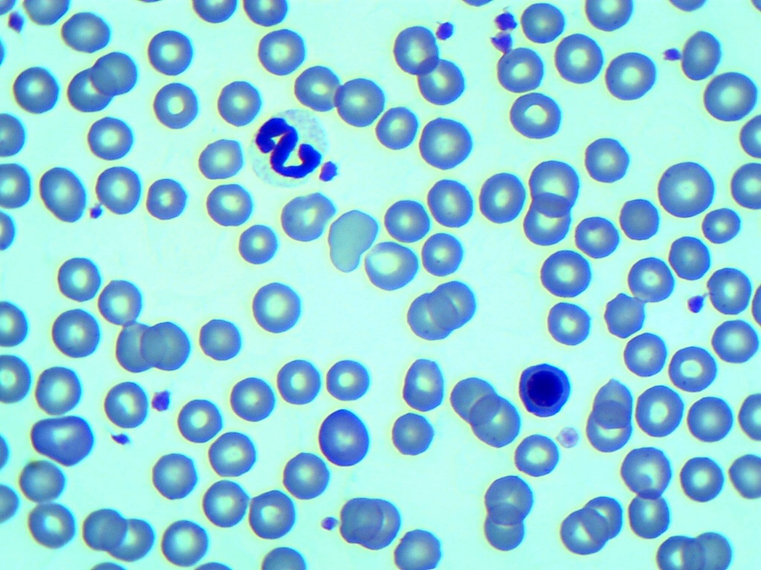 Photo of cells Photo of cells